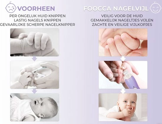 Beste Verkoop π FOOCCA Baby Nagelknipper - Oplaadbaar - Baby Manicureset - Baby Verzorgingsset - Baby Nagelvijl - Baby Nagelschaartje - Baby Nagelset - Elektrisch - Oplaadbaar π 4 Beste Verkoop π FOOCCA Baby Nagelknipper - Oplaadbaar - Baby Manicureset - Baby Verzorgingsset - Baby Nagelvijl - Baby Nagelschaartje - Baby Nagelset - Elektrisch - Oplaadbaar π - Afbeelding 4