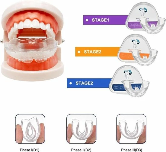 Goedkoop π₯° SAMA Direct™ Rechte Tanden Zonder Beugel - Orthodontische Bitjes - Rechte Tanden Bitje - Beugel - Knarsbitje - Nachtbeugel - Knarsen Bitje - Rechte Tanden - Witte Tanden β¨ 1 Goedkoop π₯° SAMA Direct™ Rechte Tanden Zonder Beugel - Orthodontische Bitjes - Rechte Tanden Bitje - Beugel - Knarsbitje - Nachtbeugel - Knarsen Bitje - Rechte Tanden - Witte Tanden β¨