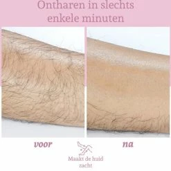 Kopen ✔️ ShopYourMusthaves S.Y.M. Crystal Hair Removal – Haarverwijderaar – Ontharing – Crystal Hair Eraser – Kristalpad – Inclusief Opbergzakje - Roze 😉 -BRAUN Shop 550x541 3