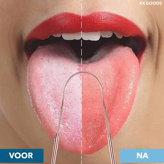 Goedkoopste ๐งจ RX Goods Rosé Gouden Tongschraper Voor Mondverzorging – 4 Stuks – Duurzaam & Herbruikbaar ๐ 2 Goedkoopste ๐งจ RX Goods Rosé Gouden Tongschraper Voor Mondverzorging – 4 Stuks – Duurzaam & Herbruikbaar ๐ - Afbeelding 2