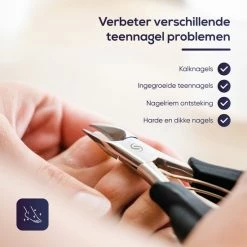 Korting 🔥 Skeraxo® Professionele Pedicureset Nageltang Kalknagel - Met Nagelvijl & Vuil Verwijderaar - Nagelschaar Voor Harde Teennagels – Nagelknipper Ingegroeide Teennagel - Inclusief Teennagel Correctors 😀 16 Korting 🔥 Skeraxo® Professionele Pedicureset Nageltang Kalknagel - Met Nagelvijl & Vuil Verwijderaar - Nagelschaar Voor Harde Teennagels – Nagelknipper Ingegroeide Teennagel - Inclusief Teennagel Correctors 😀 -BRAUN Shop 550x550 444