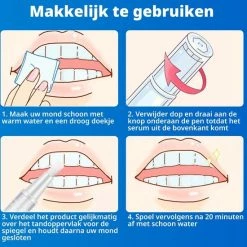 Beste Pirce ⌛ Efero Tanden Bleekpen - Teeth Whitening Pen - Tanden Bleker - Wittere Tanden - Teeth Whitening Strips - Professioneel Resultaat - Tandsteen Verwijderaar - Zonder Peroxide - Tandenbleekset - Tanden Bleken – Sinterklaas – Schoencadeautjes Sinterklaas 🤩 -BRAUN Shop 550x556 8