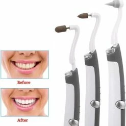 Hete verkoop ✨ LOUZIR Elektrische Tandsteen/Tandplak Verwijderaar- 3 Opzetstukken - Tandenplijsten - Tandenbleker - Flosapparaat 😉