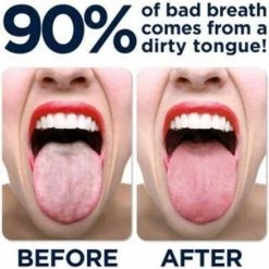 Goedkoopste π₯ Maharishi Ayurveda RVS - Tongschraper π 8 Goedkoopste π₯ Maharishi Ayurveda RVS - Tongschraper π -BRAUN Shop 550x557 6