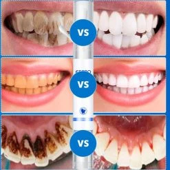 Beste Pirce ⌛ Efero Tanden Bleekpen - Teeth Whitening Pen - Tanden Bleker - Wittere Tanden - Teeth Whitening Strips - Professioneel Resultaat - Tandsteen Verwijderaar - Zonder Peroxide - Tandenbleekset - Tanden Bleken – Sinterklaas – Schoencadeautjes Sinterklaas 🤩 -BRAUN Shop 550x560 7