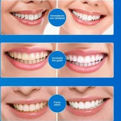 Beste Pirce ⌛ Efero Tanden Bleekpen - Teeth Whitening Pen - Tanden Bleker - Wittere Tanden - Teeth Whitening Strips - Professioneel Resultaat - Tandsteen Verwijderaar - Zonder Peroxide - Tandenbleekset - Tanden Bleken – Sinterklaas – Schoencadeautjes Sinterklaas 🤩 -BRAUN Shop 550x564 4