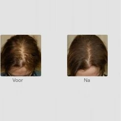 Beste Verkoop 😀 FOLIGAIN – Lotion Tegen Haaruitval Voor Vrouwen – 59 Ml 🔔 -BRAUN Shop 550x604 1